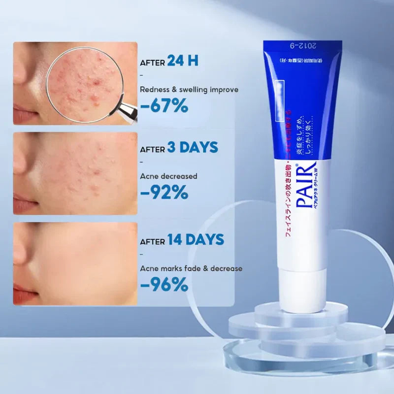 Crema Anti Acne PAIR